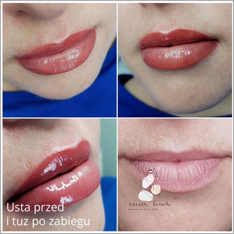 Usta Idealne - Makijaż Permanentny Ust Powiększa Usta!