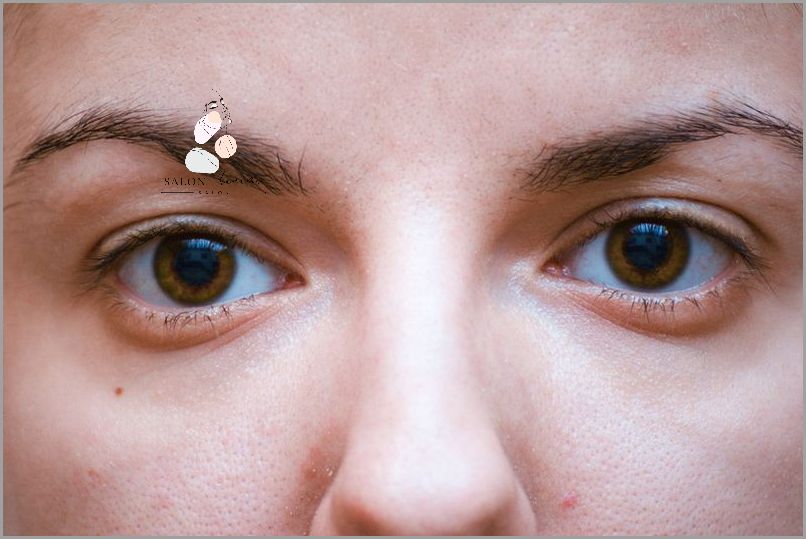 Uwaga: Opuchnięte Oczy Rano - Przyczyny!