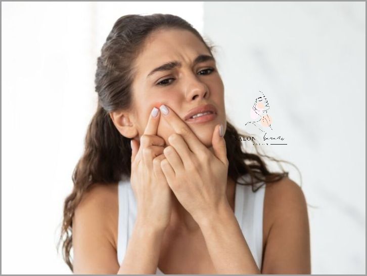 Uwaga! Podskórne Krosty Na Twarzy - Jak je usunąć?