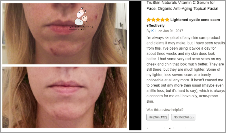 Zaskocz Sie Efektem: Serum Z Witaminą C Wizaz!