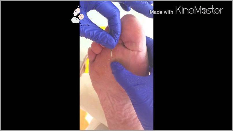 Zobacz Jak Wygląda Odcisk Z Korzeniem! Zobacz Jak Wygląda Odcisk Z Korzeniem!