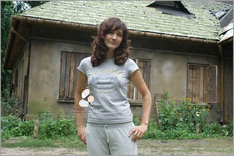 Zobacz, Jak Wyglądają Potówki - Zdjęcia!