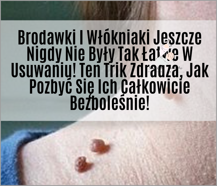 Zobacz Zdjęcia: Jak Wyglądają Hemoroidy!