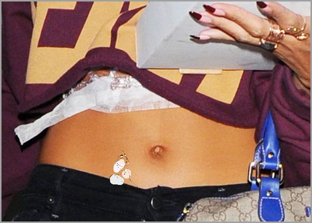 10 Zdjęć Odparzeń Pod Piersiami! 10 Zdjęć Odparzeń Pod Piersiami!