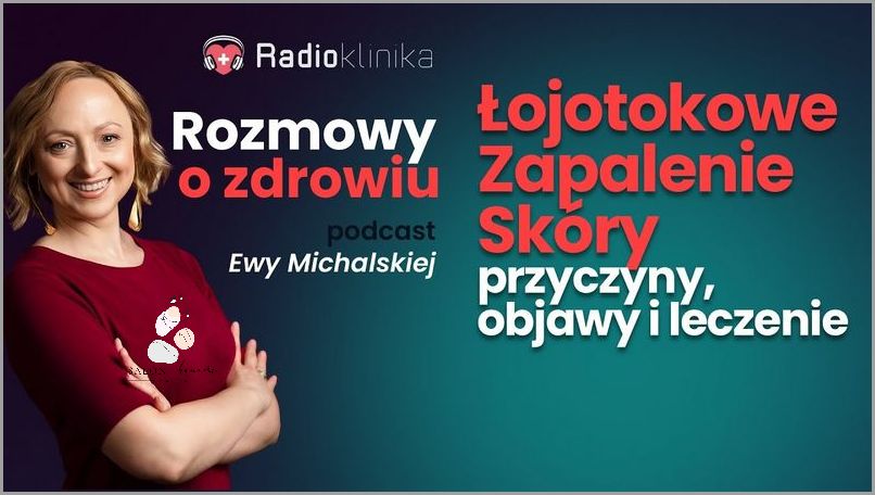 7 Domowych Sposobów Na Łojotokowe Zapalenie Skóry U Niemowląt