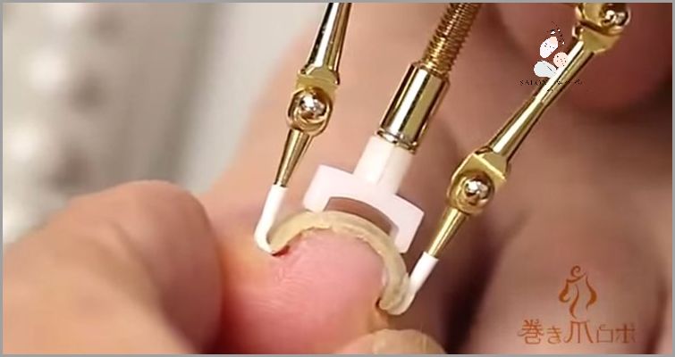 7 Skutecznych Domowych Sposobów Na Wrastający Paznokieć