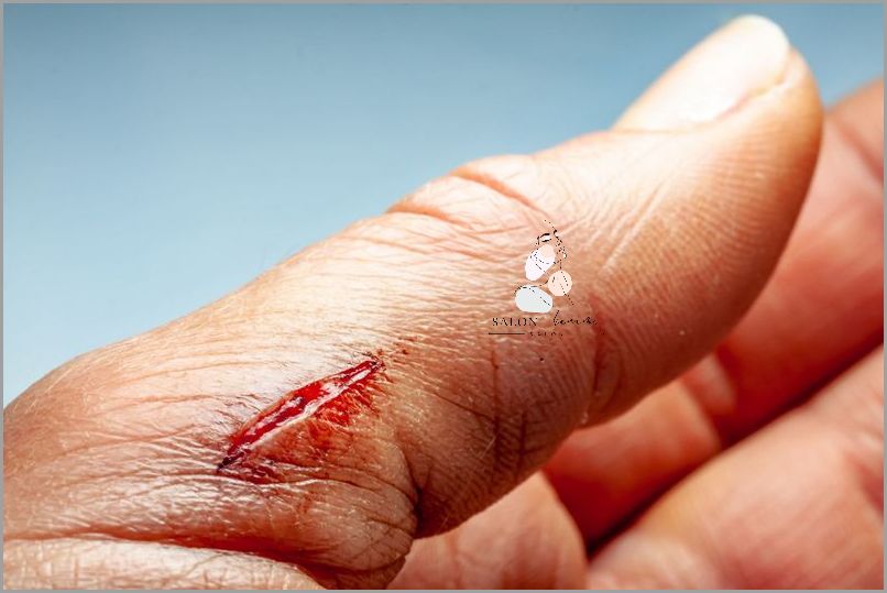 Cera Naczynkowa - Jak Wyglada?