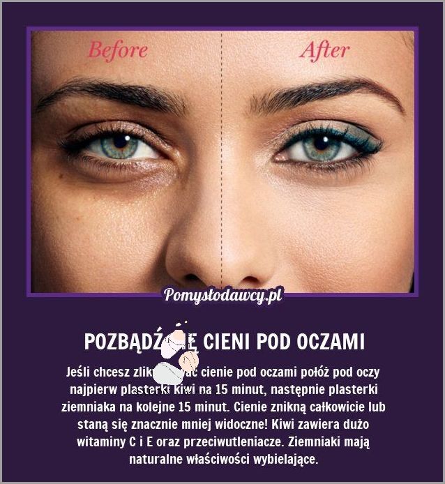 Co Na Cienie Pod Oczami? Sprawdź Te Triki!