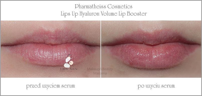 Cudowne Efekty Lips Up Serum Powiększające Usta!