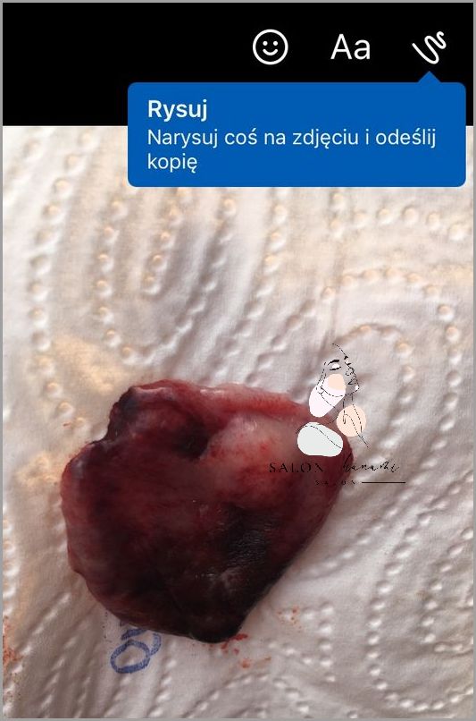 Forum: Co na Pieczenie Pochwy?