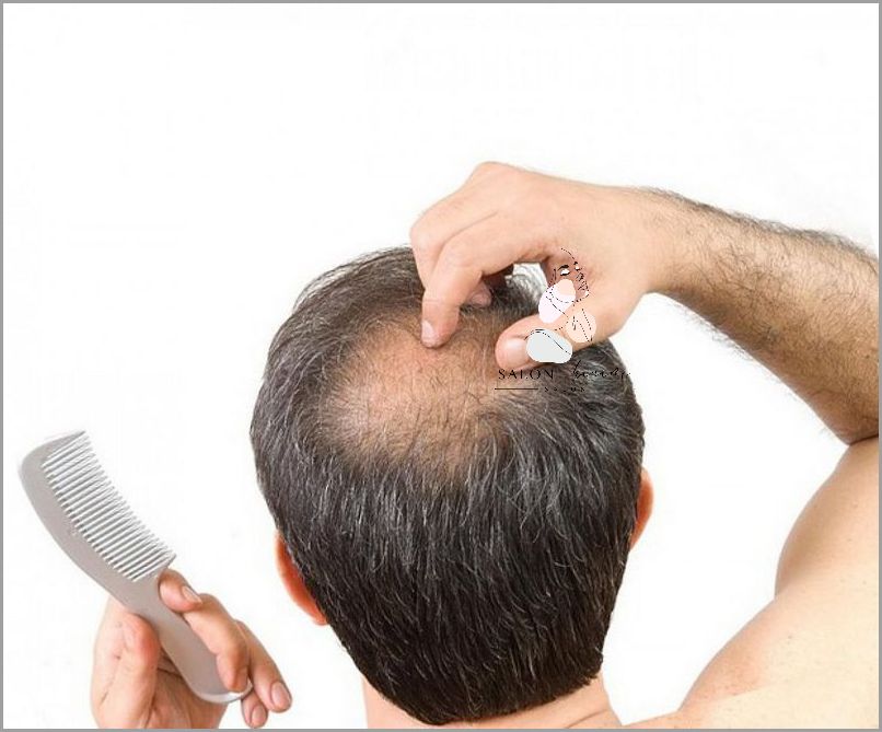 Forum: Domowe Sposoby Na Wypadanie Włosów!