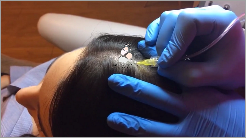 Forum: Nadmierne Wypadanie Włosów - Co Zrobić?