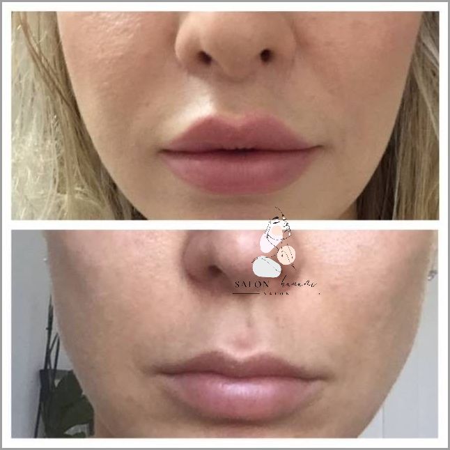 Forum Użytkowników Po Operacji Żylaków - Przeczytaj!