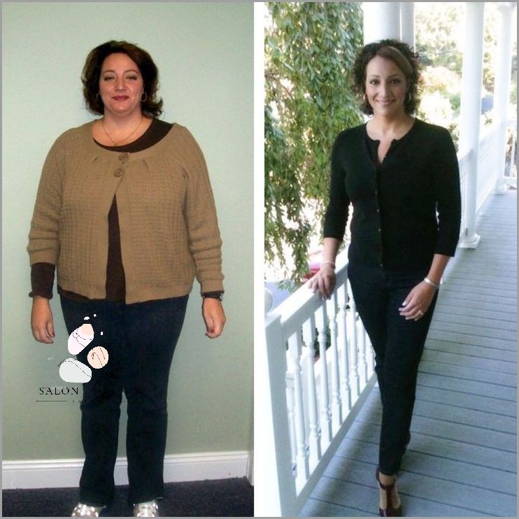 Ile Schudłyście Po Wycięciu Woreczka Żółciowego?