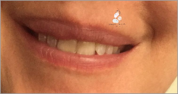 Ile Utrzymuje Sie Opalenizna? Zaskakująca Odpowiedź!