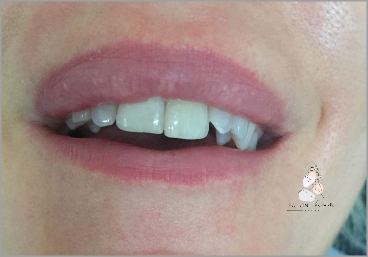 Ile Utrzymuje Sie Opalenizna? Zaskakująca Odpowiedź!