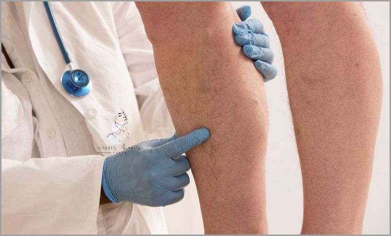 Jak Leczyć Krwiaka? Co Na Krwiaka!