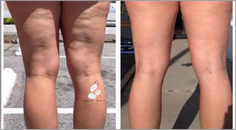 Jak Szczotkować Na Sucho? Przekonaj Się!