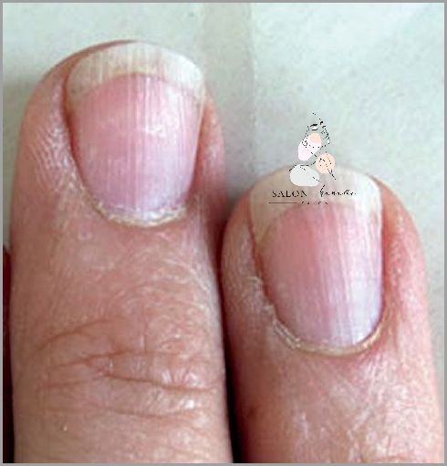 Jak Zdobyć Piękne Paznokcie Rosnące Do Góry?