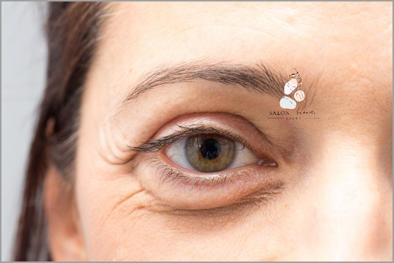 Lekarze alarmują: Opuchlizna pod jednym okiem! Lekarze alarmują: Opuchlizna pod jednym okiem!