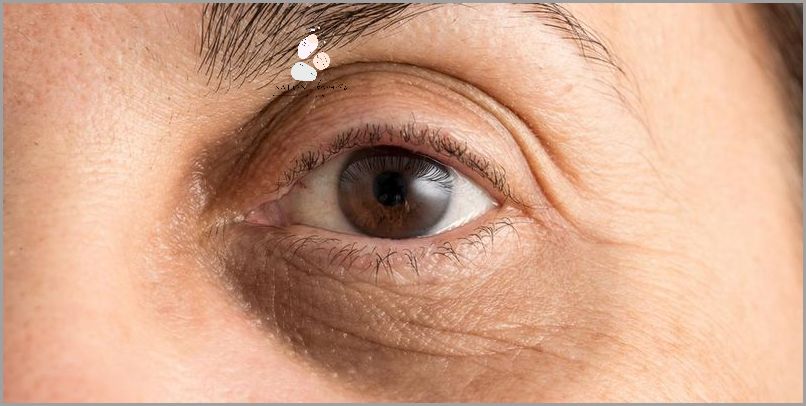 Lekarze alarmują: Opuchlizna pod jednym okiem! Lekarze alarmują: Opuchlizna pod jednym okiem!