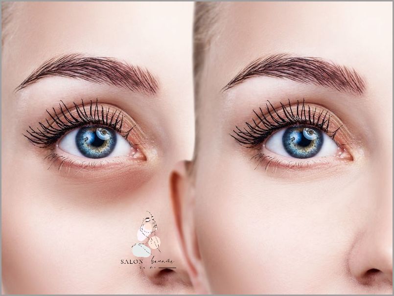 Lekarze alarmują: Opuchlizna pod jednym okiem! Lekarze alarmują: Opuchlizna pod jednym okiem!