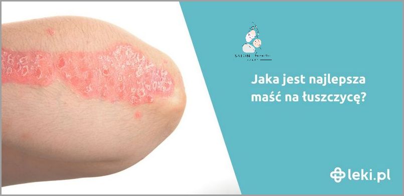 Najlepsza Maść na Łojotokowe Zapalenie Skóry - Sprawdź! Najlepsza Maść na Łojotokowe Zapalenie Skóry - Sprawdź!