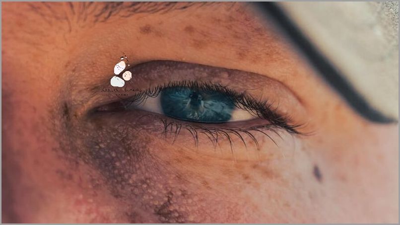 Niespodziewana Czarna Plamka W Polu Widzenia!