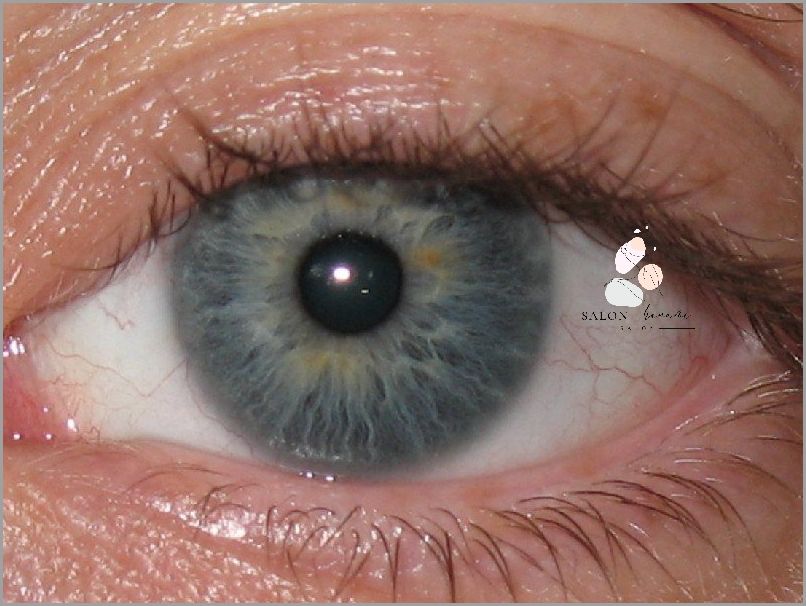 Okłady Na Swędzące Oczy: Niesamowite Sposoby Na Ulgę!