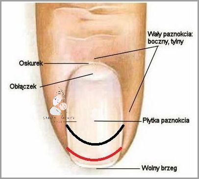 Paznokieć Odkleja Się Od Palca
