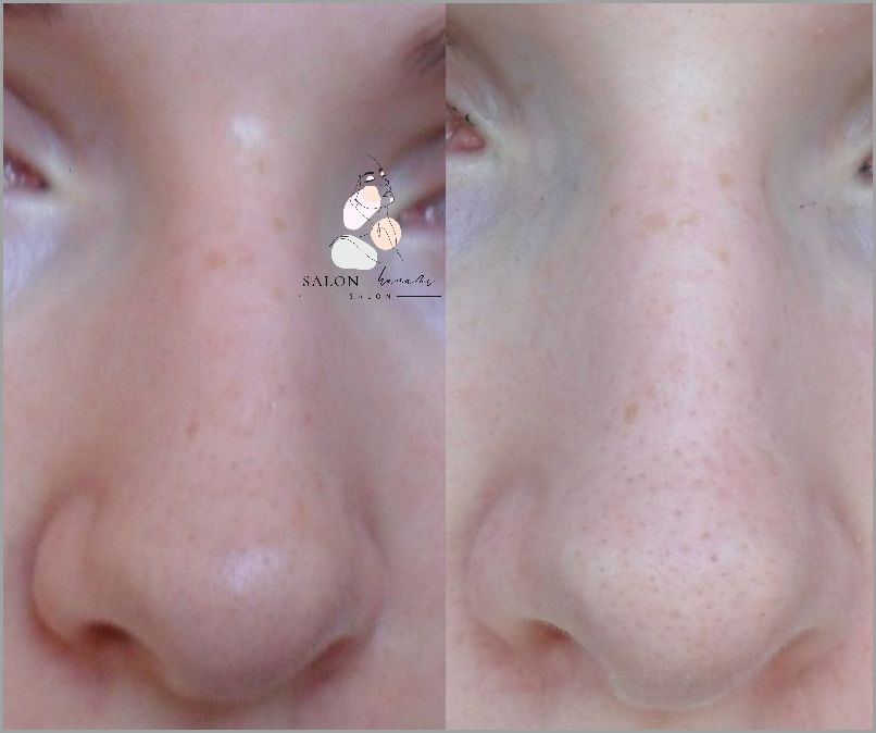 Peeling Przed Czy Po Goleniu? Sprawdź Teraz!