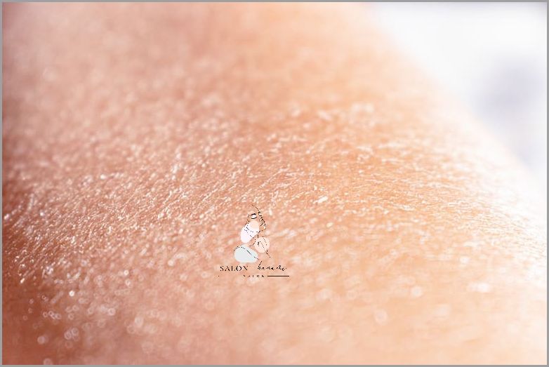 Pękanie skóry przy paznokciach - przyczyny i skuteczne leczenie.