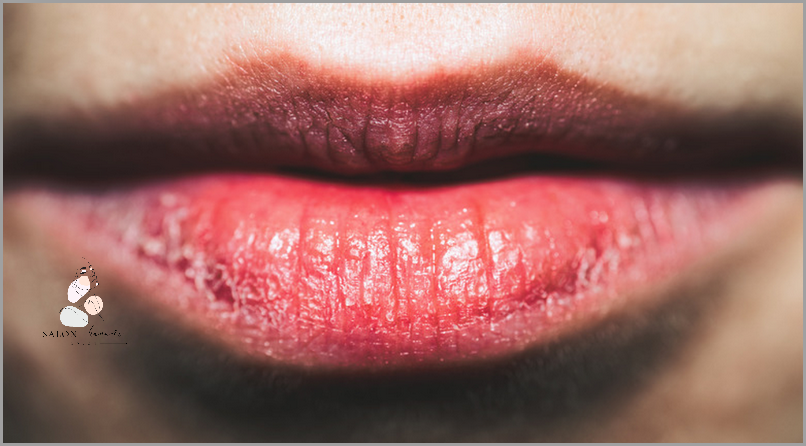 Pękanie skóry przy paznokciach - przyczyny i skuteczne leczenie.