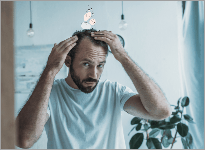 Skuteczne Wcierki Na Łysienie Androgenowe!