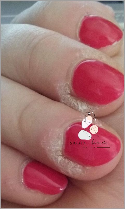 Tajemnice Suchych Paznokci Wokół Skóry!