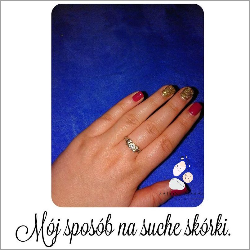 Ujawniamy Skuteczny Sposób na Schodzącą Skórę Z Dłoni!