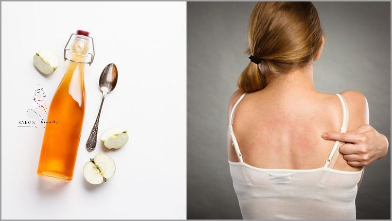 Ujędrnij Skórę: Ocet Jabłkowy Na Plamy Starcze!