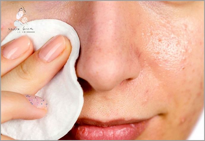 Ujędrzające Zabiegi Na Rozszerzone Pory!