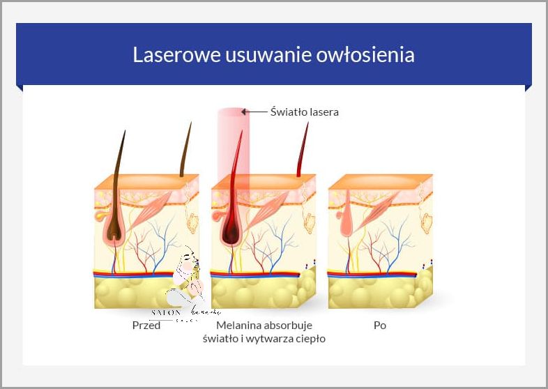 Usuwanie Owłosienia Z Twarzy: Skuteczne Domowe Sposoby!