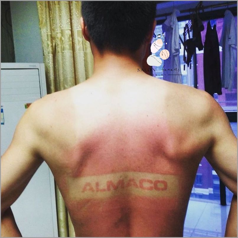 Uwaga! Żółte Plamy Pod Pachami Są Groźne!