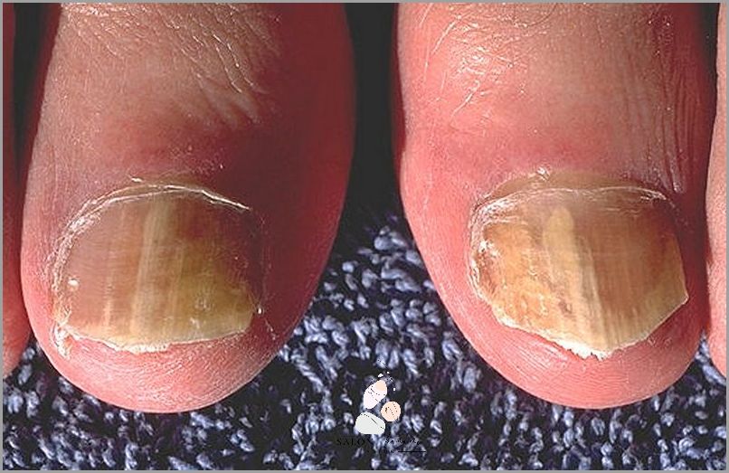 Zaskakująca Przyczyna Przebarwień Paznokci U Nóg! Zaskakująca Przyczyna Przebarwień Paznokci U Nóg!