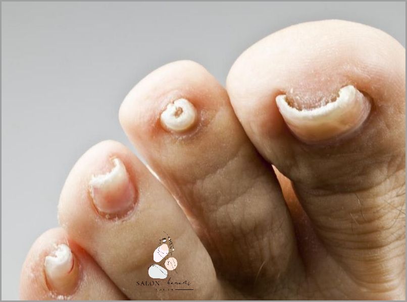 Zaskakująca Przyczyna Przebarwień Paznokci U Nóg! Zaskakująca Przyczyna Przebarwień Paznokci U Nóg!