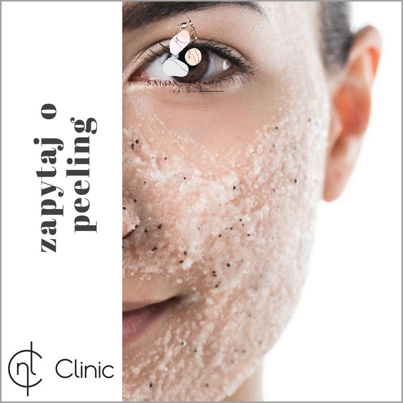 Zaskakujące Efekty Zelu z Kwasem Salicylowym!