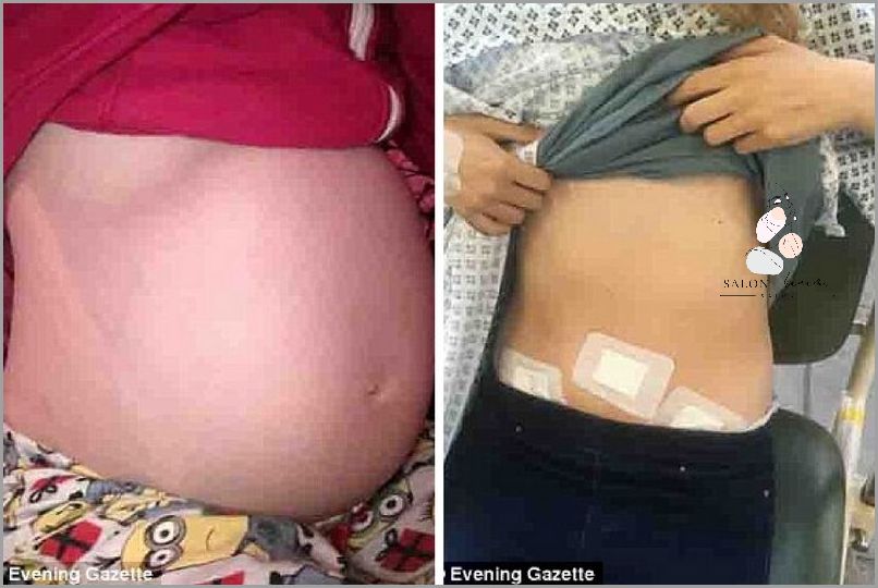 Zobacz Zdjęcia Ułożenia Dziecka W Brzuchu!