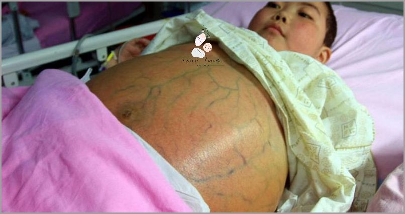 Zobacz Zdjęcia Ułożenia Dziecka W Brzuchu!