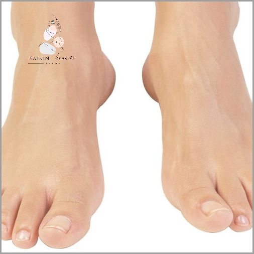 10 Skutecznych Sposobów na Popękane Pięty!