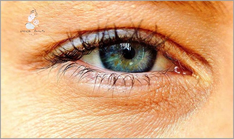 7 Domowych Sposobów Na Czerwone Oczy! 7 Domowych Sposobów Na Czerwone Oczy!