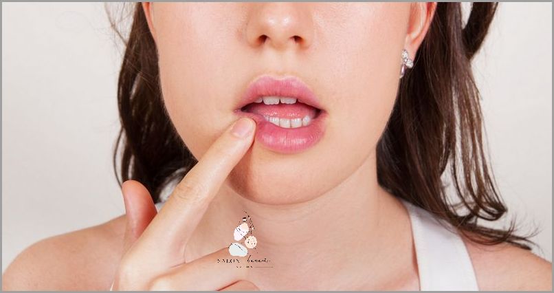 7 Skutecznych Domowych Sposobów Na Opryszczkę!