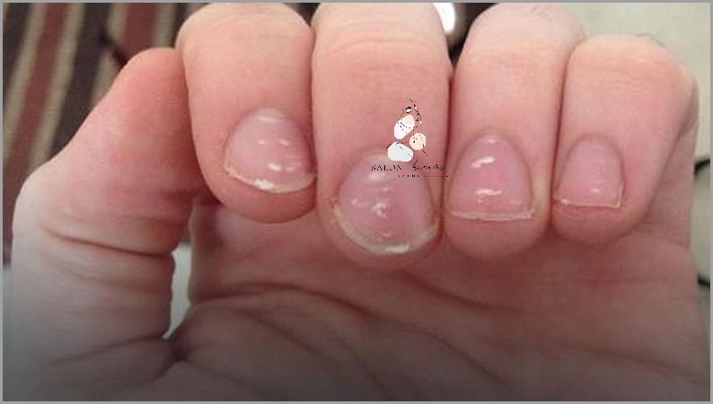 Białe Plamki Na Paznokciach U Dziecka - Sprawdź Czym Są! Białe Plamki Na Paznokciach U Dziecka - Sprawdź Czym Są!