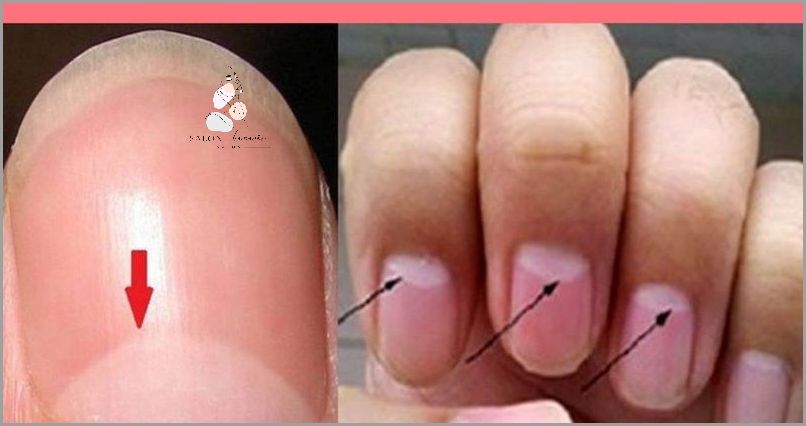 Białe Plamki Na Paznokciach U Dziecka - Sprawdź Czym Są! Białe Plamki Na Paznokciach U Dziecka - Sprawdź Czym Są!